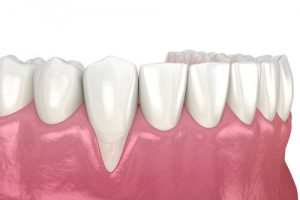 achieving optimal oral health