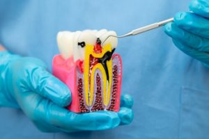 teeth of a drug addict cavities