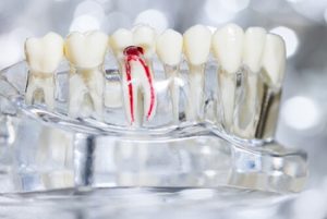 teeth of a drug addict root